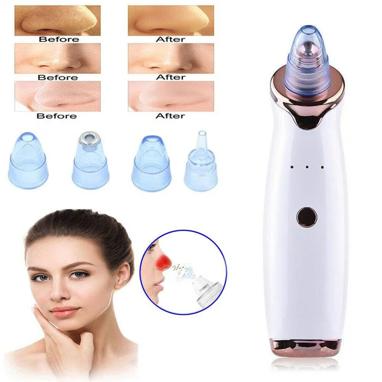 

Facial Blackhead Remover Vacuum Pore Cleaner USB Rechargeable Electric Pore Clean Acne Comedone Pimple Blackhead Extractor, White