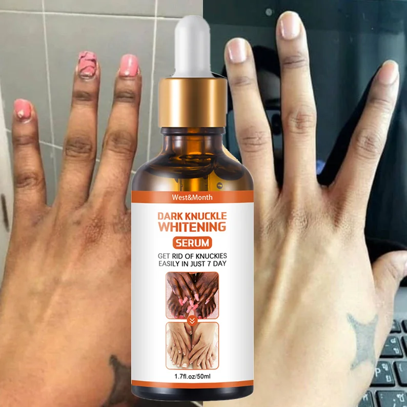 

skincare Dark Knuckles Fast Whitening Serum Pigmentation Correctors Hand Knuckle Elbows Knee Intense Stains Remover beauty Serum