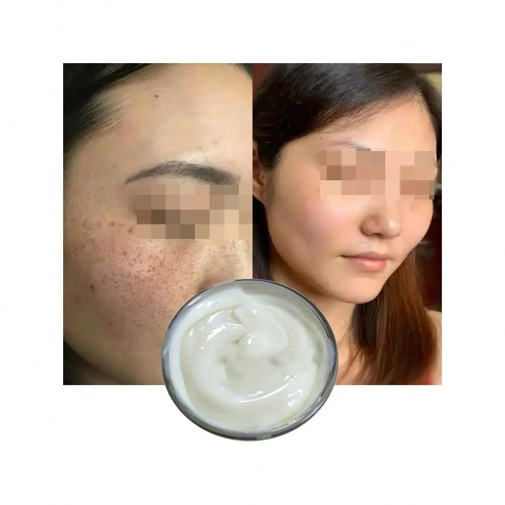 

Organic Skincare Products Face Firming Cream For Women Improves Dark Skin Anti Aging Collagen Whitening Cream Sold by Weight