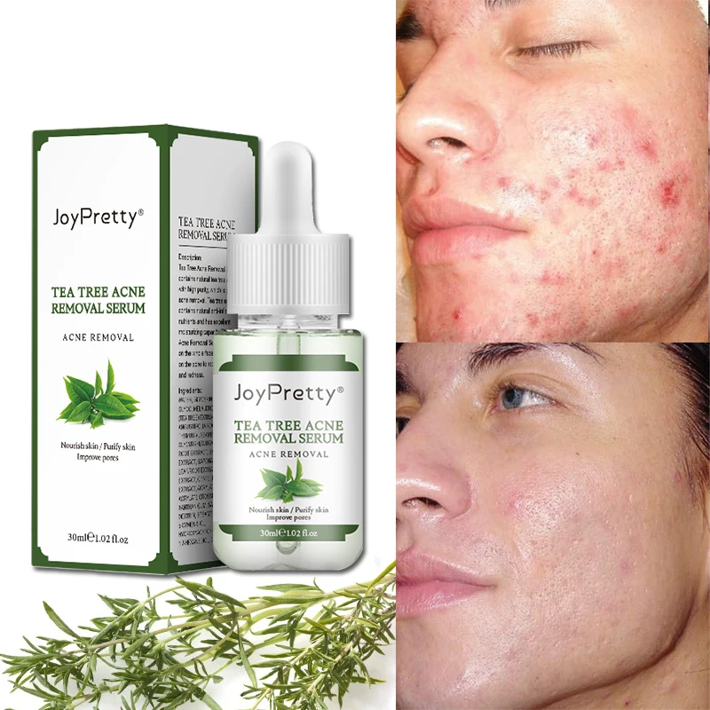 

Korean Private Label OEM Collagen Organic Tea Tree Acne Removal Anti Aging Wrinkle Brightening Whitening Face Collagen Serum