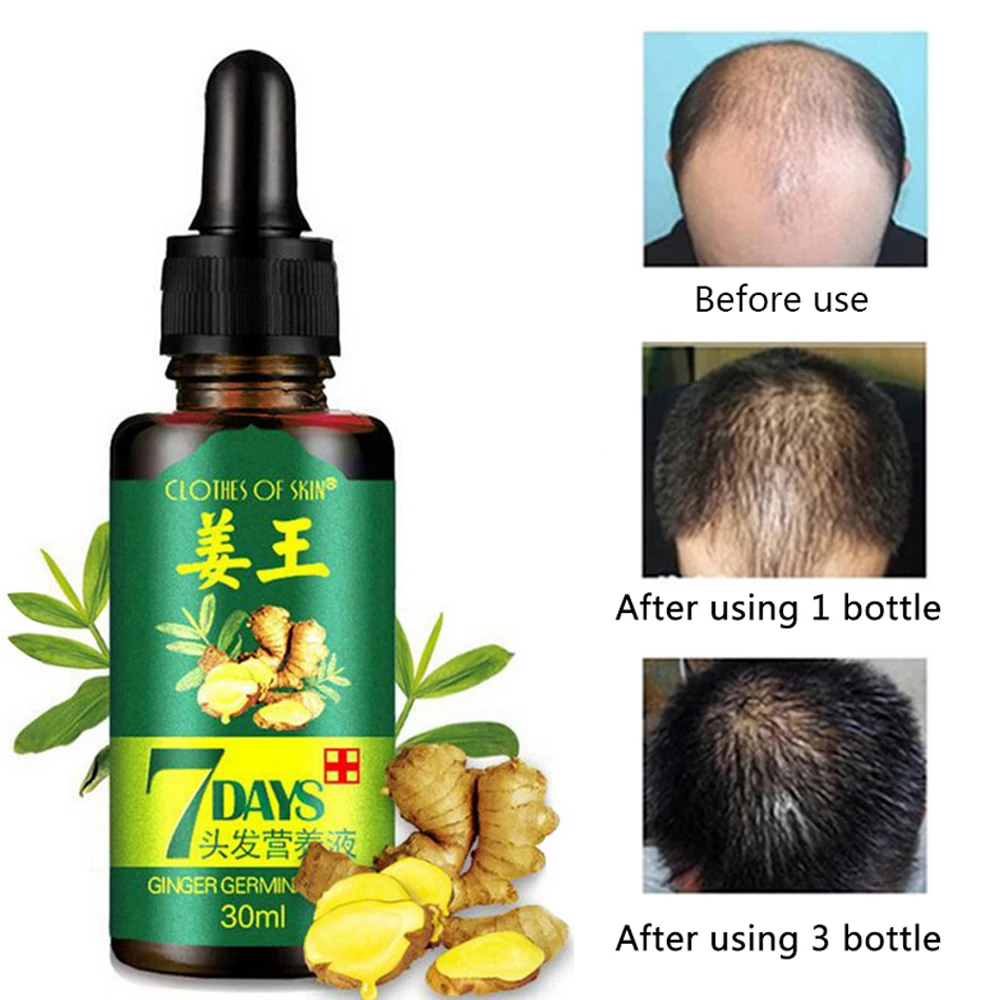 

30ml Hair Growth Serum Esence for Women and Men Anti preventing Hair Loss alopecia Liquid Damaged Hair Repair Growing Faster
