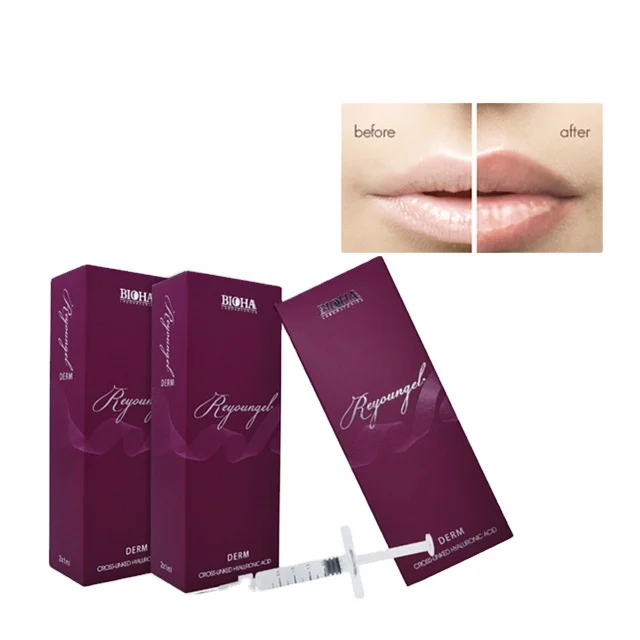 
Reyoungel Cross-linked acid hialuronico Injectable Filler For Rhinoplasty 