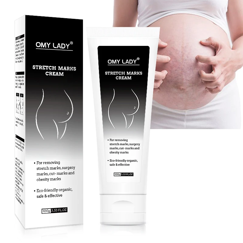 

removing stretch marks