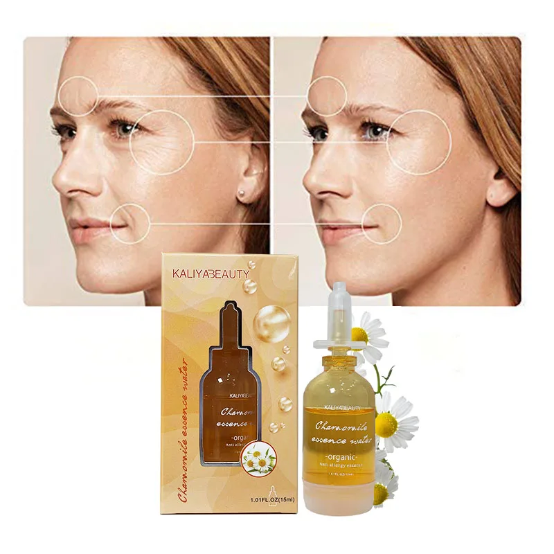 

Amazon Top Sale Chamomile Facial Serum Natural Soothing Skin Repairing Facial Problems Reduce Acne Pimples Hydrating For Unisex