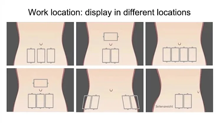 Fat Removing Skin Tightening with 1060nm wavelength 4 handle Fat Burning Professional Diode Fat Burning Machine