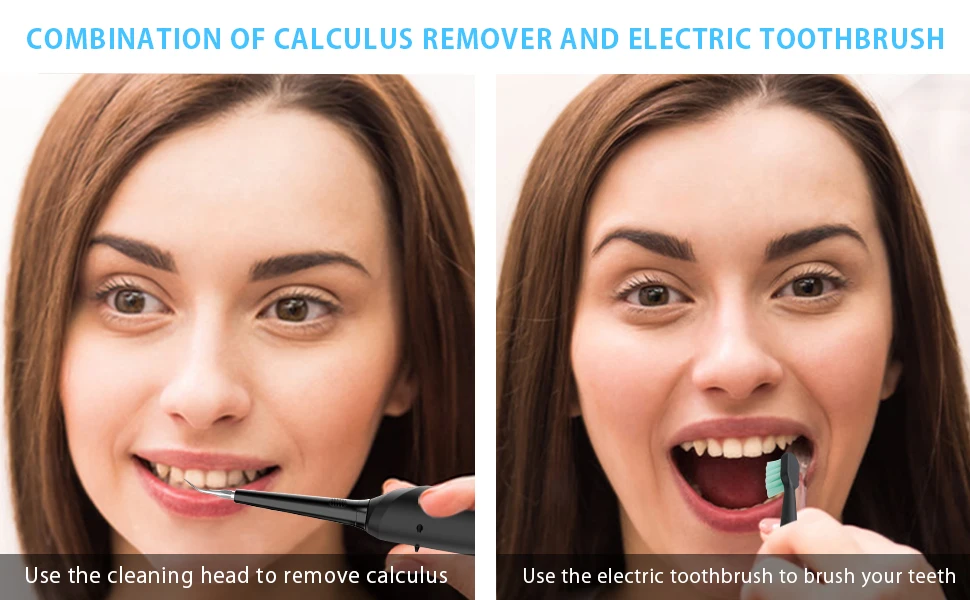 Eco Friendly Tartar Stain Teeth Plaque Black Calculus Remover Electric