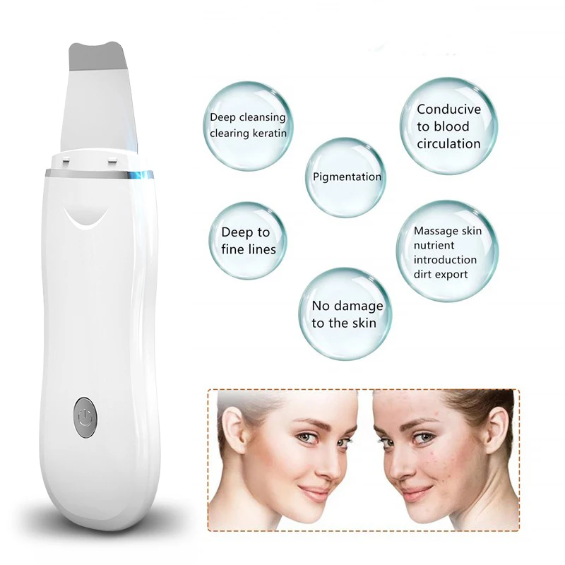 

Ultrasonic Skin Scrubber Ion Deep Cleaning Blackhead Remover Peeling Shovel Acne Pore Cleaner Exfoliating Face Spatula Lifting, White