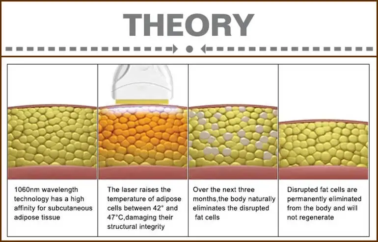  how does the Fat Removing Skin Tightening with 1060nm wavelength 4 handle Fat Burning Professional Diode Fat Burning Machine works?