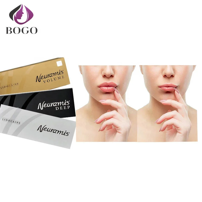 

Easy operation hyaluronate acid gel lip injections acido hialuronico inyectable