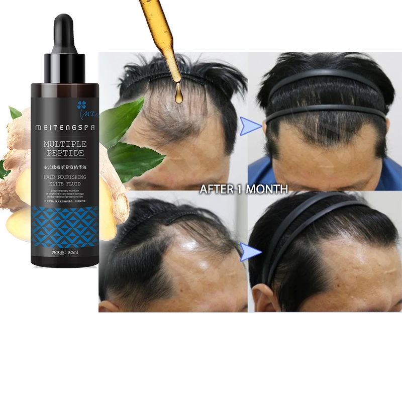 

wholesale hair regrowth oil Anti loss treatment repair damage grow hair OEM / ODM hair tonic