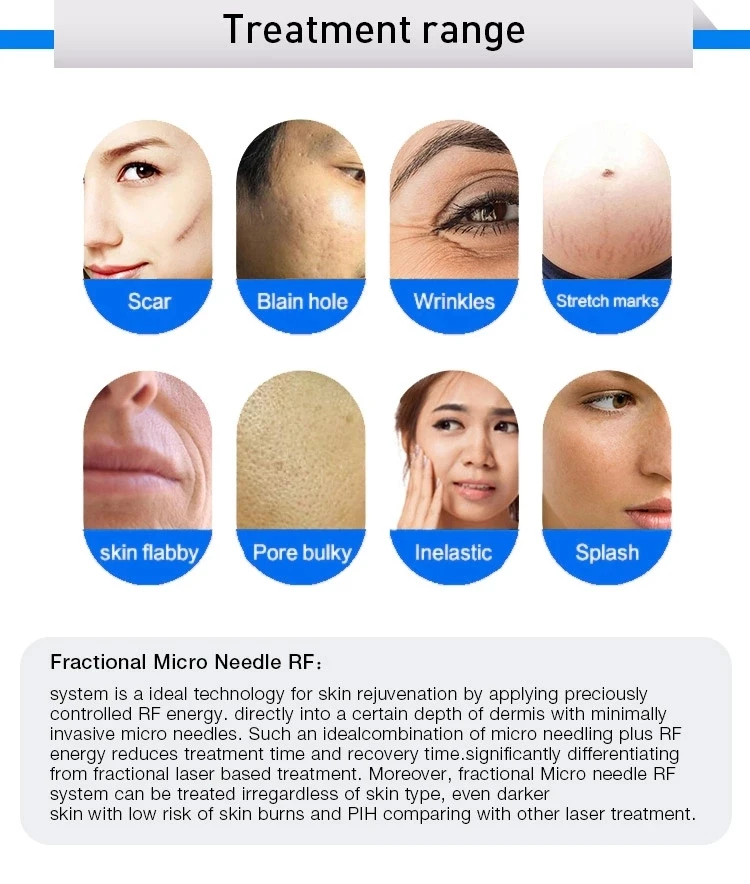 New edition microneedle rf machine facial lifting beauty instrument skin rejuvenation machine for spa and clinic use
