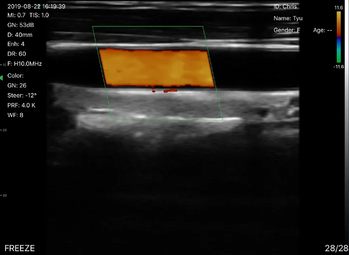 
Color Ultrasound Doppler Machine with Trolley SS-2000 Sonostar Manufacturer 