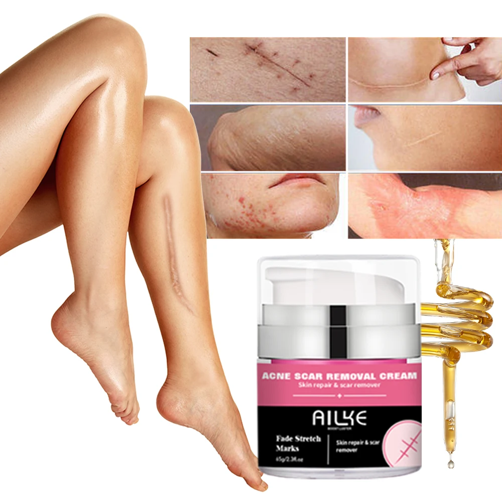 

ailke Smooth Skin Plant Extract Hydrolyzed Collagen Lightening Anti-Acne Removing Stretch Acne Scar Removal Cream