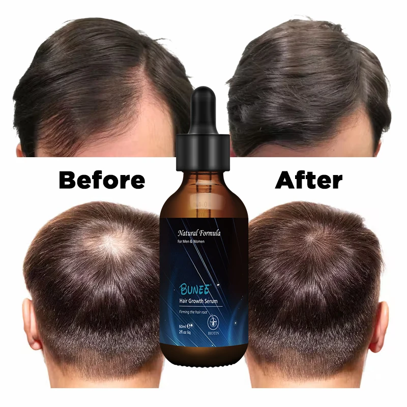 

Private Label Reduces Dandruff Moisturizing Hair Growth Oil Drops Biotin Oil Bottles Hair Oils For Hair Growth Serum