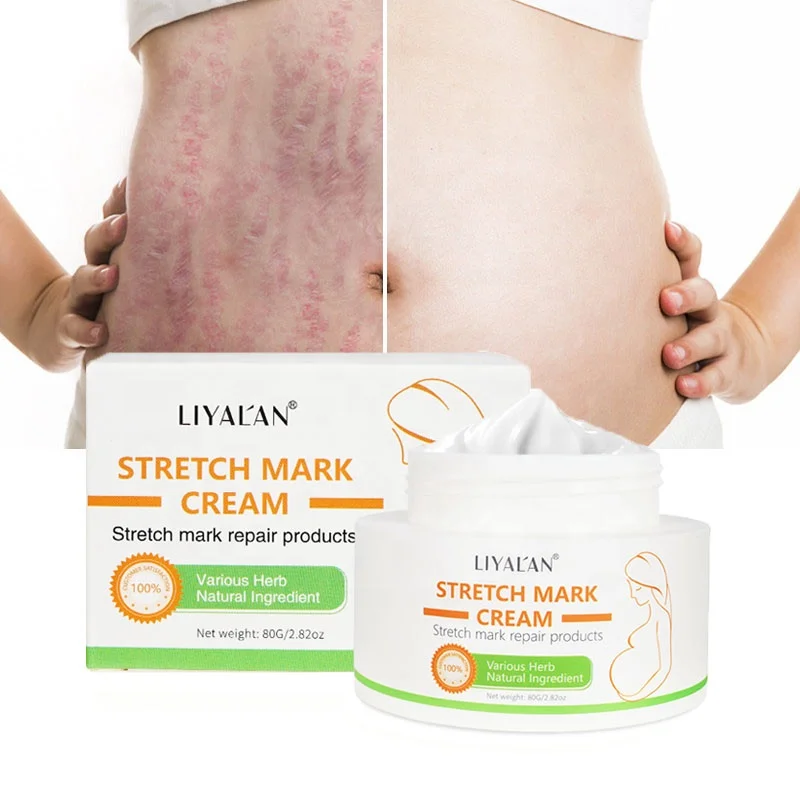 

Private Label Vegan Body Skincare Breast Cream Best Repair Scar Removal Stretch Mark Cream, White