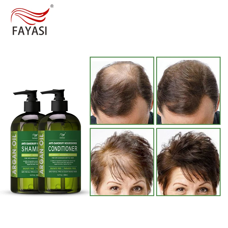 

Factory Direct Supply Korean Shampoo Korean Shampoo And Conditioner For Hair Loss Hair Treament Shampoo