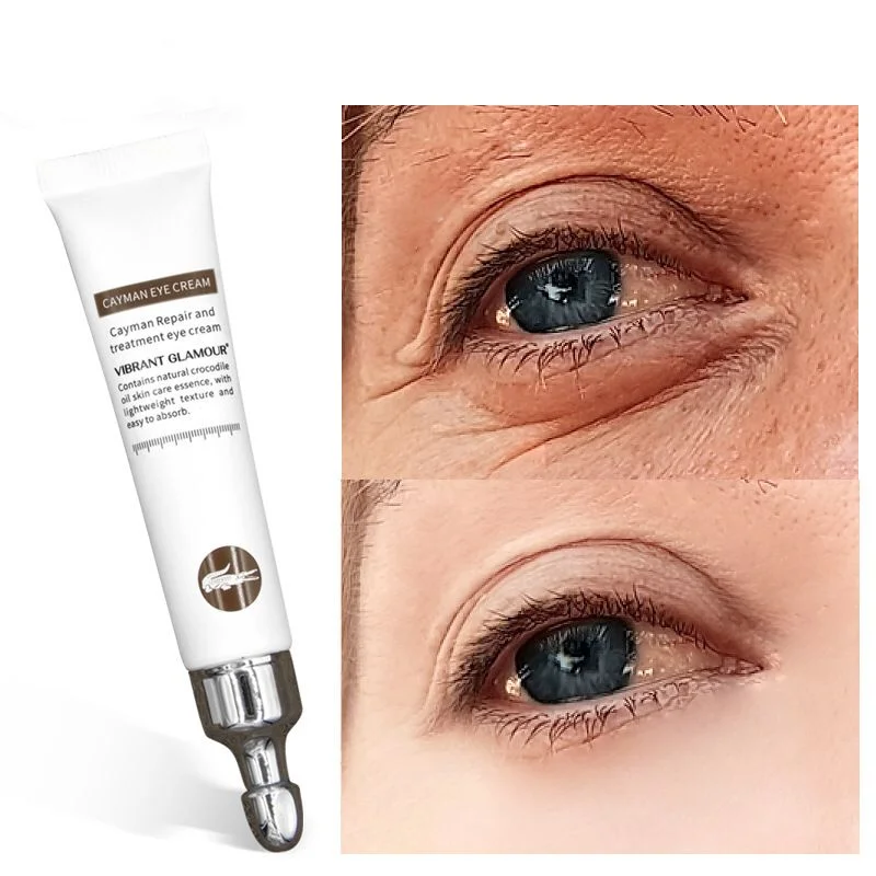 

Instant Eye Cream Fine Lines Eye Bags Instant Removal Ageless Eye Cream