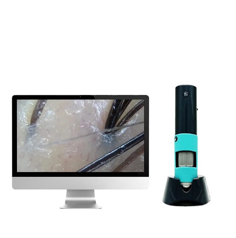 

High quality scalp diagnostic hair follicle hair analysis scalp camera 3 megapixel 600X WiFi connection to mobile phone tablet, Black