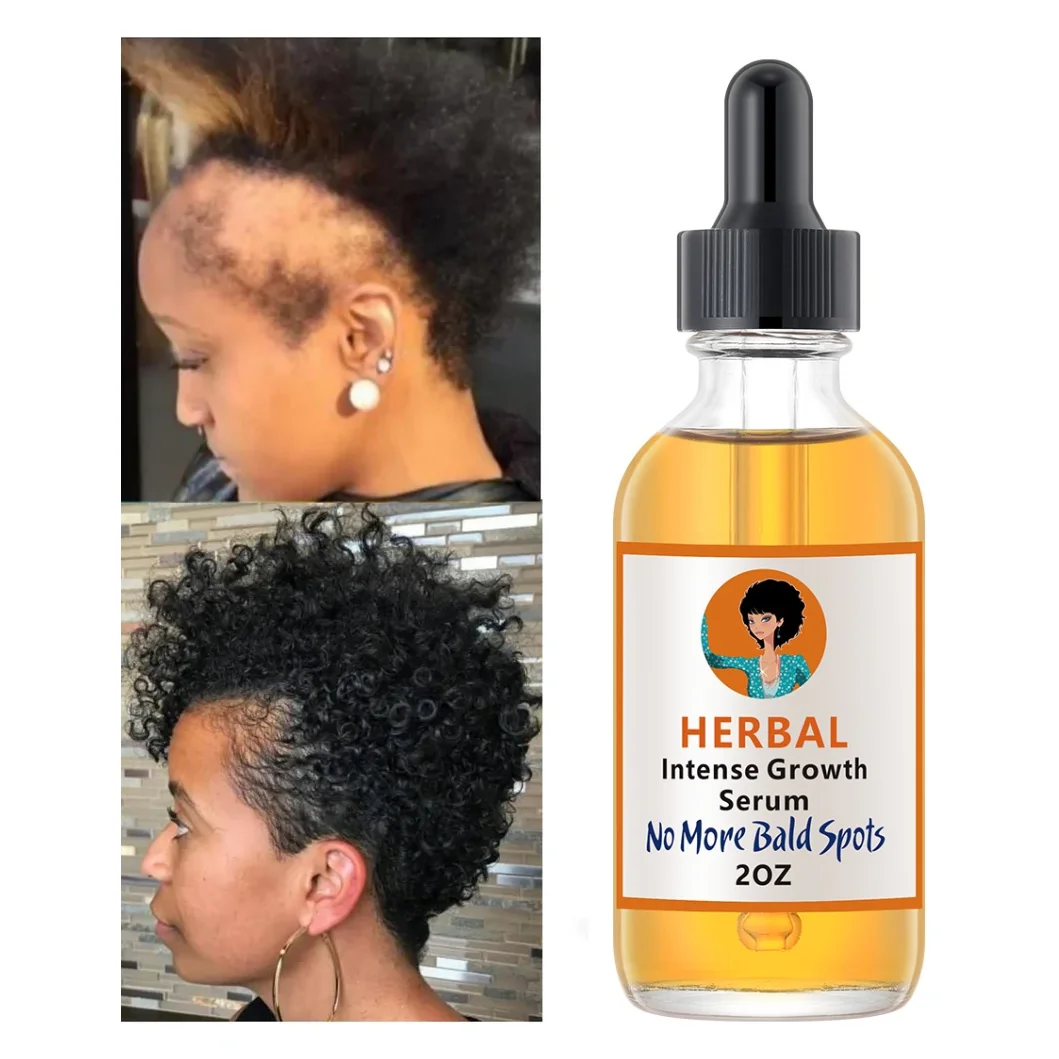 

Private Label 2oz Organic Hair Growth Serum Smoothing Hair Care Hair Growth Oil