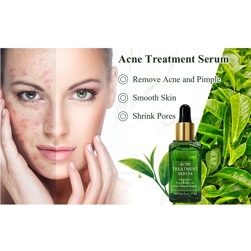 pimple remove serum
