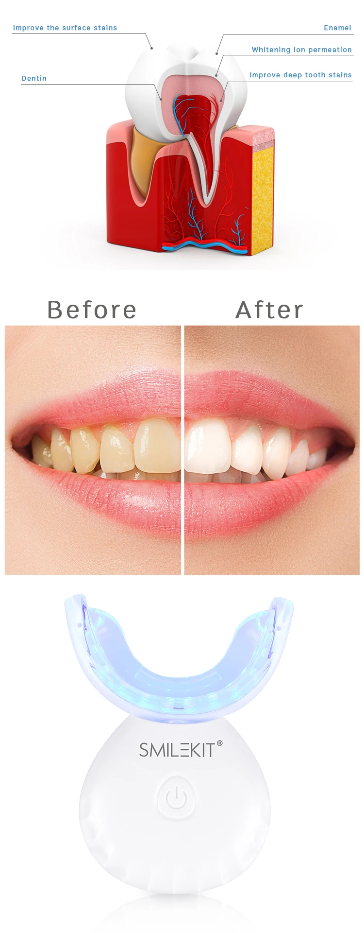 Smilekit Portable Waterproof Wireless White Teeth Whitening 16/24/32 Led Cold Light Teeth