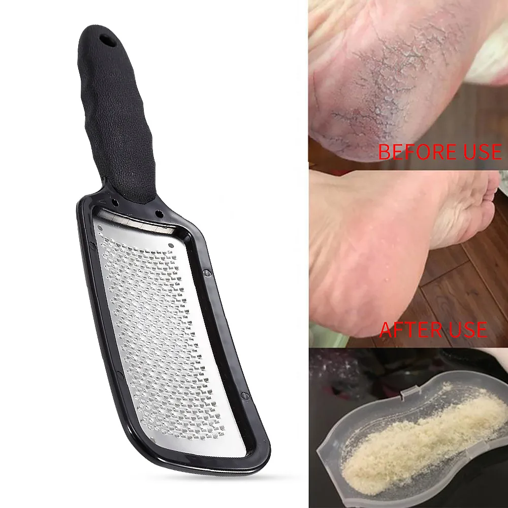 Callus Remover Corn Trimmer Colossal Pedicure Scrubber Tool Foot Rasp