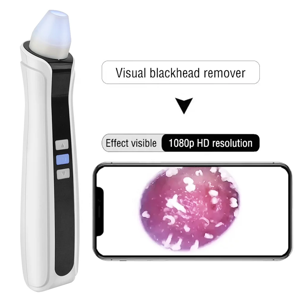 

Home Use USB Rechargeable Facial Pore Cleaner Blackhead Remover Vacuum with Camera