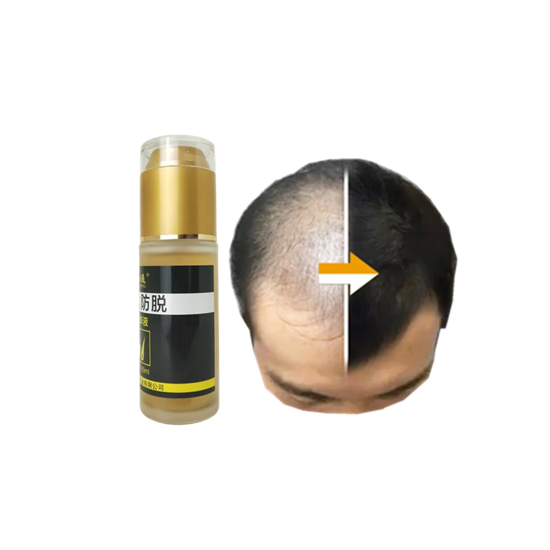 

Effective serum hair growth oil uses men's rogaineing foam for hair loss