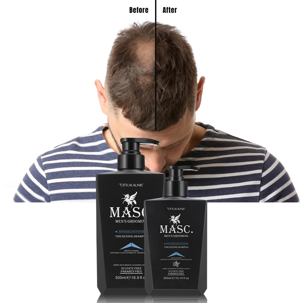 

Private label hair care products organic argan oi growth treatment hair loss shampoo