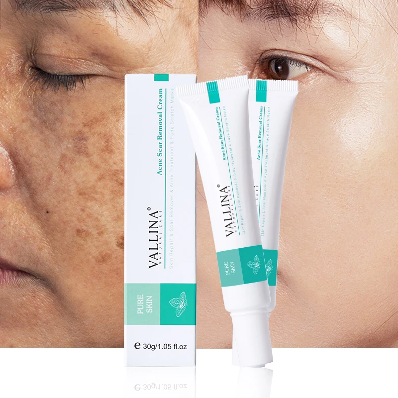 

Private Label pimples dark spot repair gel age spot remover cream