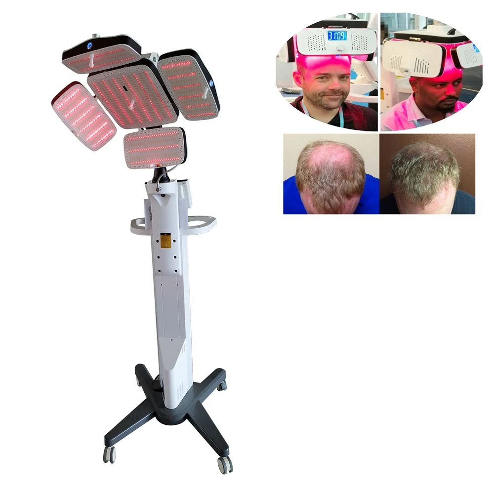

Medical use LLLT 650nm laser diode hair growth machine