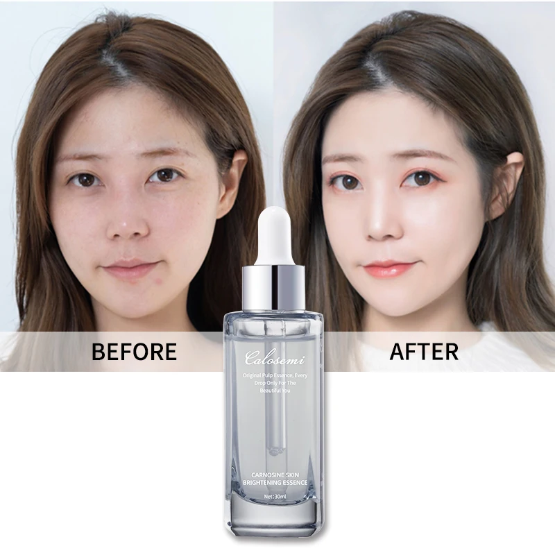 

2021 Calosemi 30ml Hydrating Skin Care Serum Anti Aging Whitening Brightening Face Serum, Gray