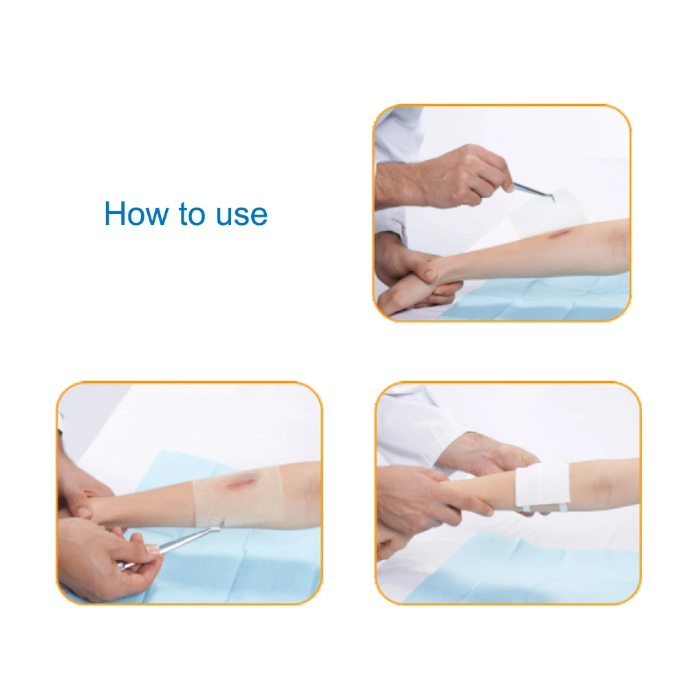 10*7cm absorbent sterile paraffine gauze dressing medical wound