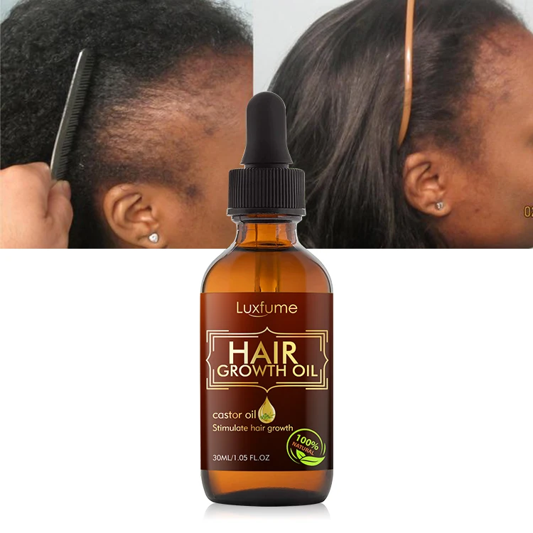 

BELLEZON Private Label Natural Organic Biotin Hair Growth Oil Serum For Men And Women Anti Hairloss Serum