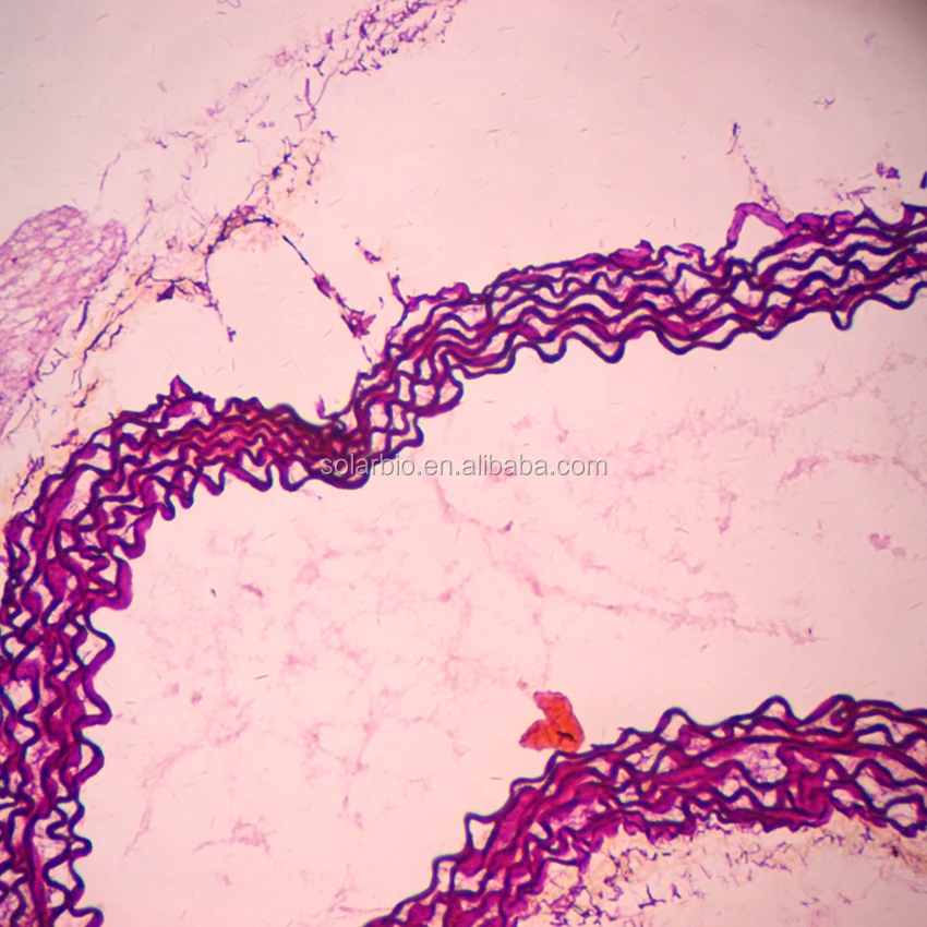 Modified Gomori AldehydeFuchsin Stain Kit for Elastic Tissue