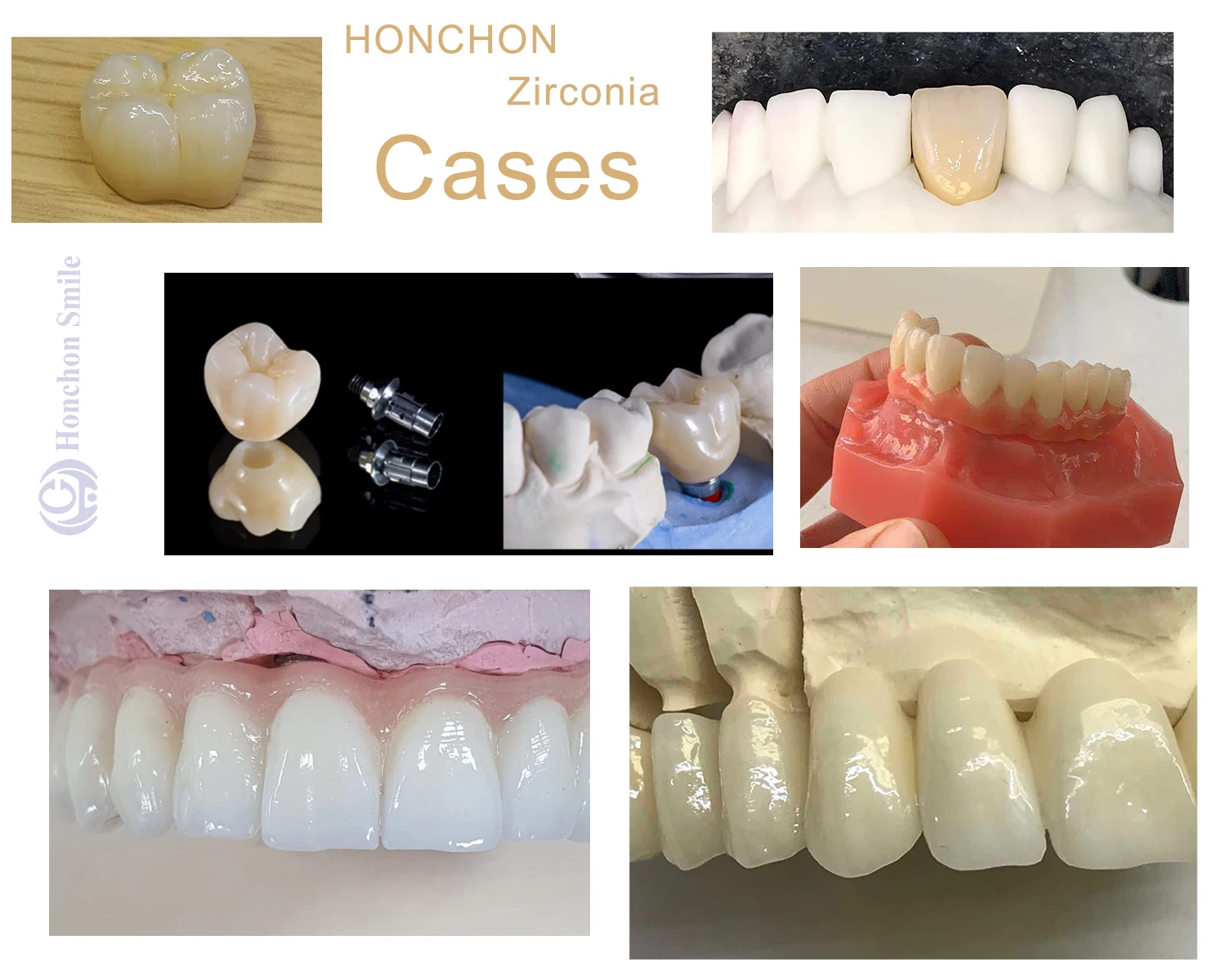 HONCHON zirconia cases