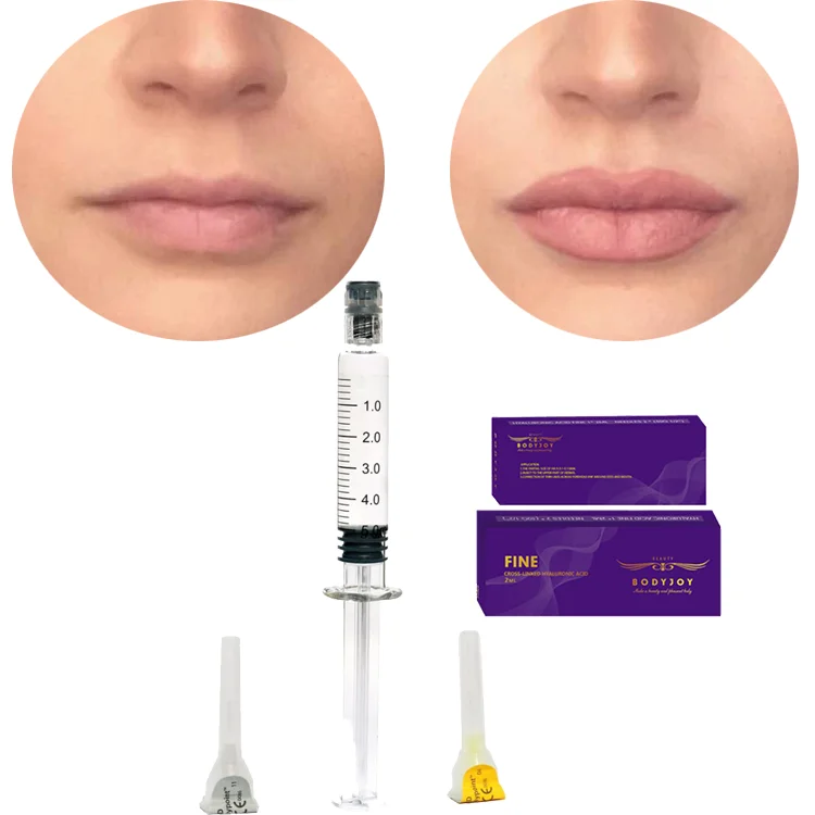

5ml cross-linked hyaluronic acid gel for lip enlargement