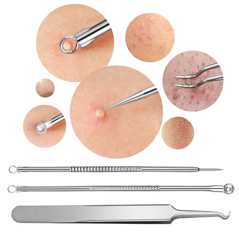 

3 PCS Stainless Steel Blackhead Facial Acne Spotted Pimple Extractor Remover Needles Acne tweezer Comedone Set for Face Cleaning