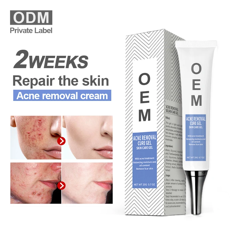 

Anti acne cream Repair Scar Gel Removal Scar Acne Cream Treatment, White