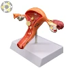 Soft Pvc Female Internal Genital Organs Uterus Anatomical Model For teaching