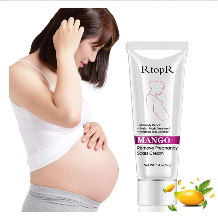 

40g Mango Stretch Marks Remover Cream Eliminate Pregnancy Scars Maternity Repair Anti Winkle Skin Firming Treatment