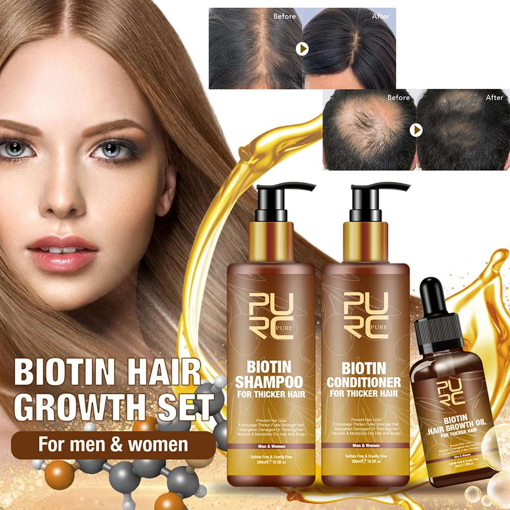 

Factory Best Natural Anti Hair Loss Shampoo Organic Biotin Thickening Hair Growth Shampoo And Conditioner Set Private Label