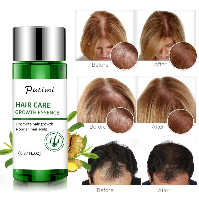 

Organic Hair Growth Oil Private Label Ginger Extract Hair Grow Oil Essence Natural Hair Loss Treatment