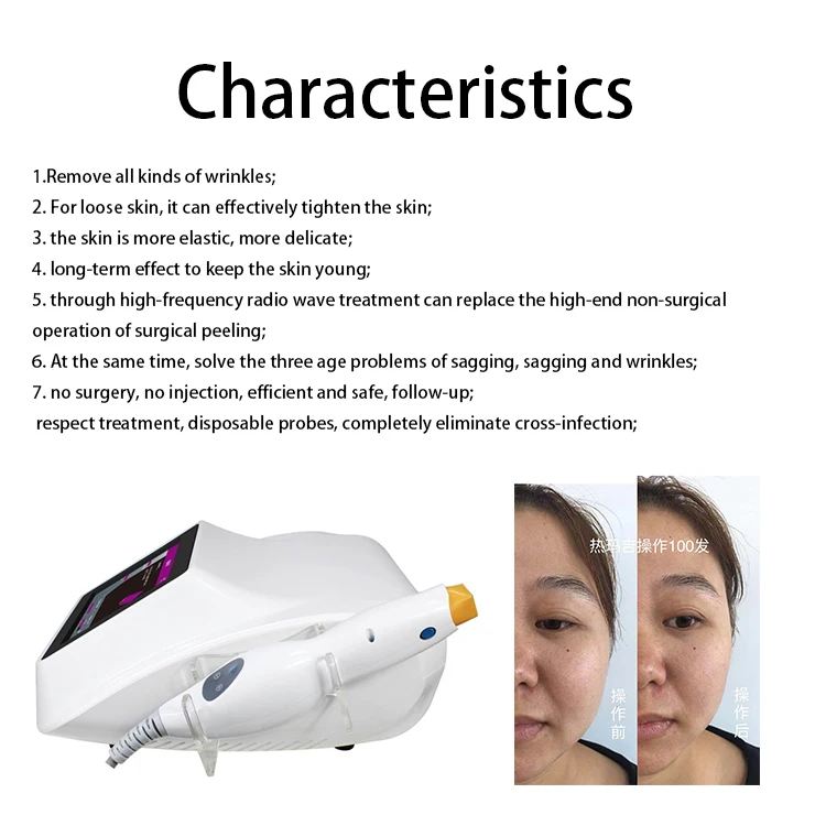 Beauty Thermagic Fractional rf Thermagie Flx Machine for skin tightening wrinkle removal