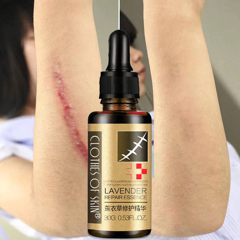 

Essential Massage Lavender Scar Removal Oil For Pregnant Women