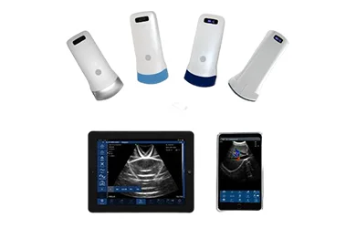 Wireless ultrasound scanner