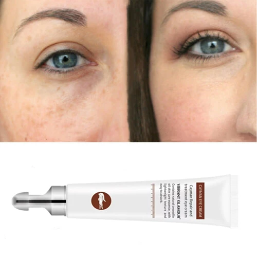 

Private label new arrival anti wrinkle dark circles SKIN WHITENING eye cream for men and woman