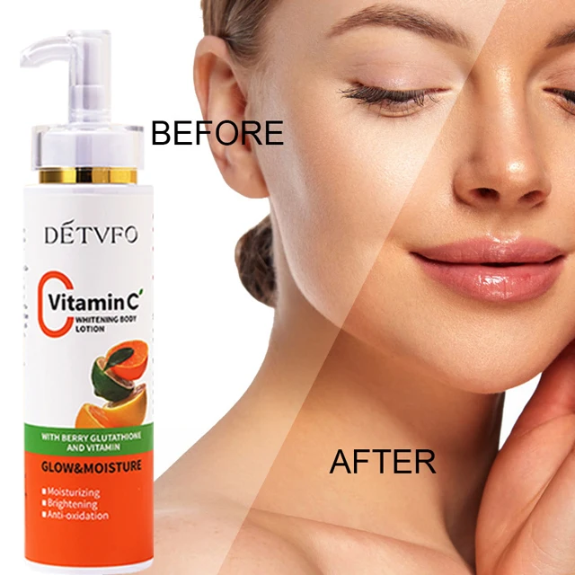 

Hyaluronic acid moisturizing korea organic vitamin e a face and body glow up whitening cream vitamin c body lotion