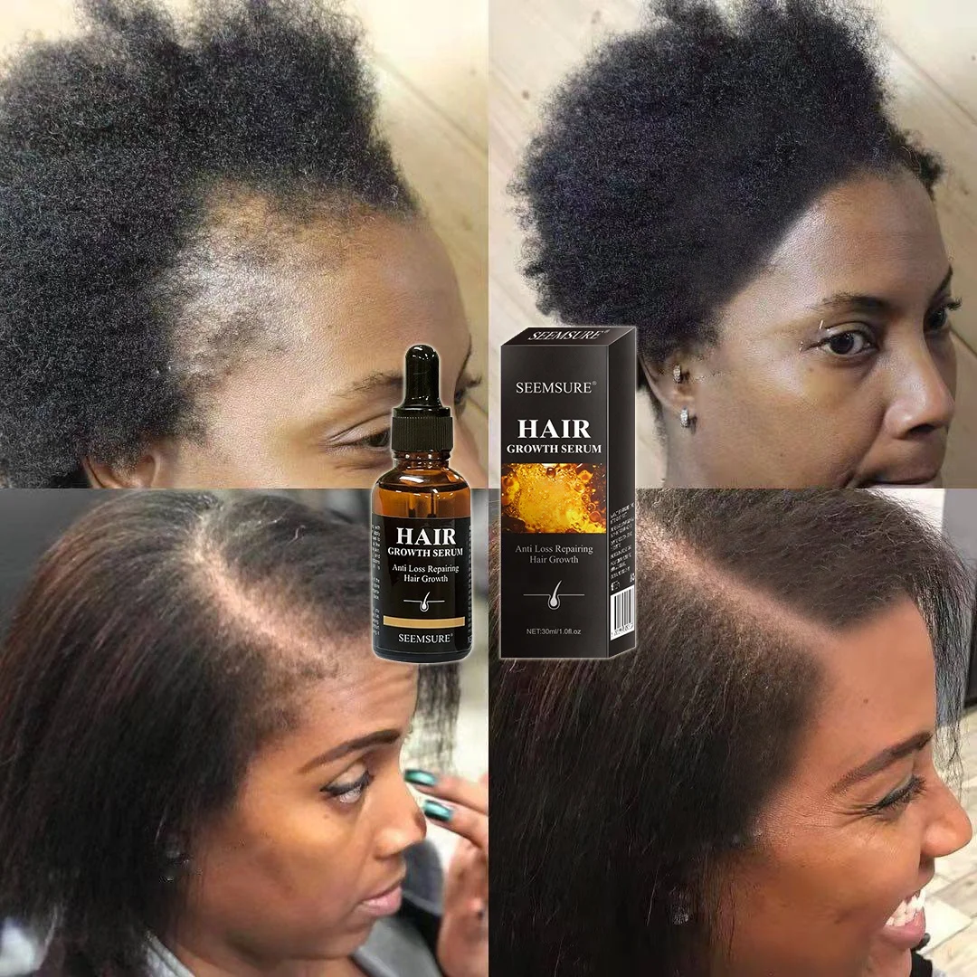 

Private Label Natural Anti Loss Nourishing Scalp Man Women Hair Serum treatment for bald hair Loss Treatment Hair Growth Oil