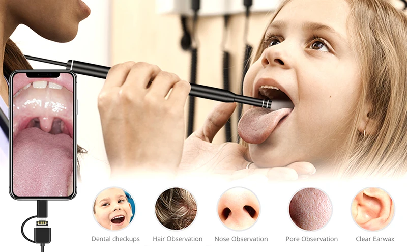 ear wax removal (10).jpg